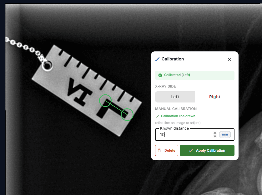 Calibration panel with a measured line drawn across a scale marker in the radiograph