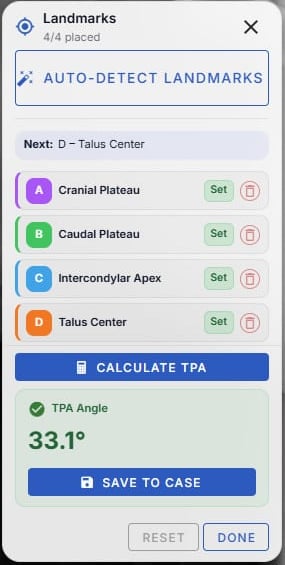 The osAlign landmarks panel showing all four landmarks set and a calculated TPA of 33.1 degrees with a save-to-case button