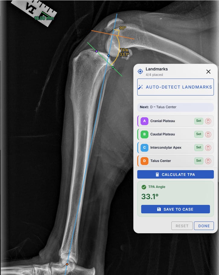 All four landmarks placed with the tibial plateau angle of 33.1 degrees calculated and displayed