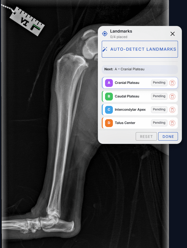 Landmarks panel guiding placement of the four tibial points, highlighting which point comes next