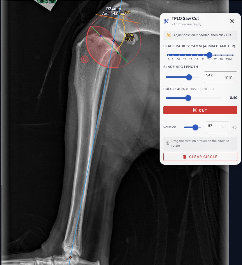 Saw cut tool with a blade-radius circle overlaid on the proximal tibia, ready to cut