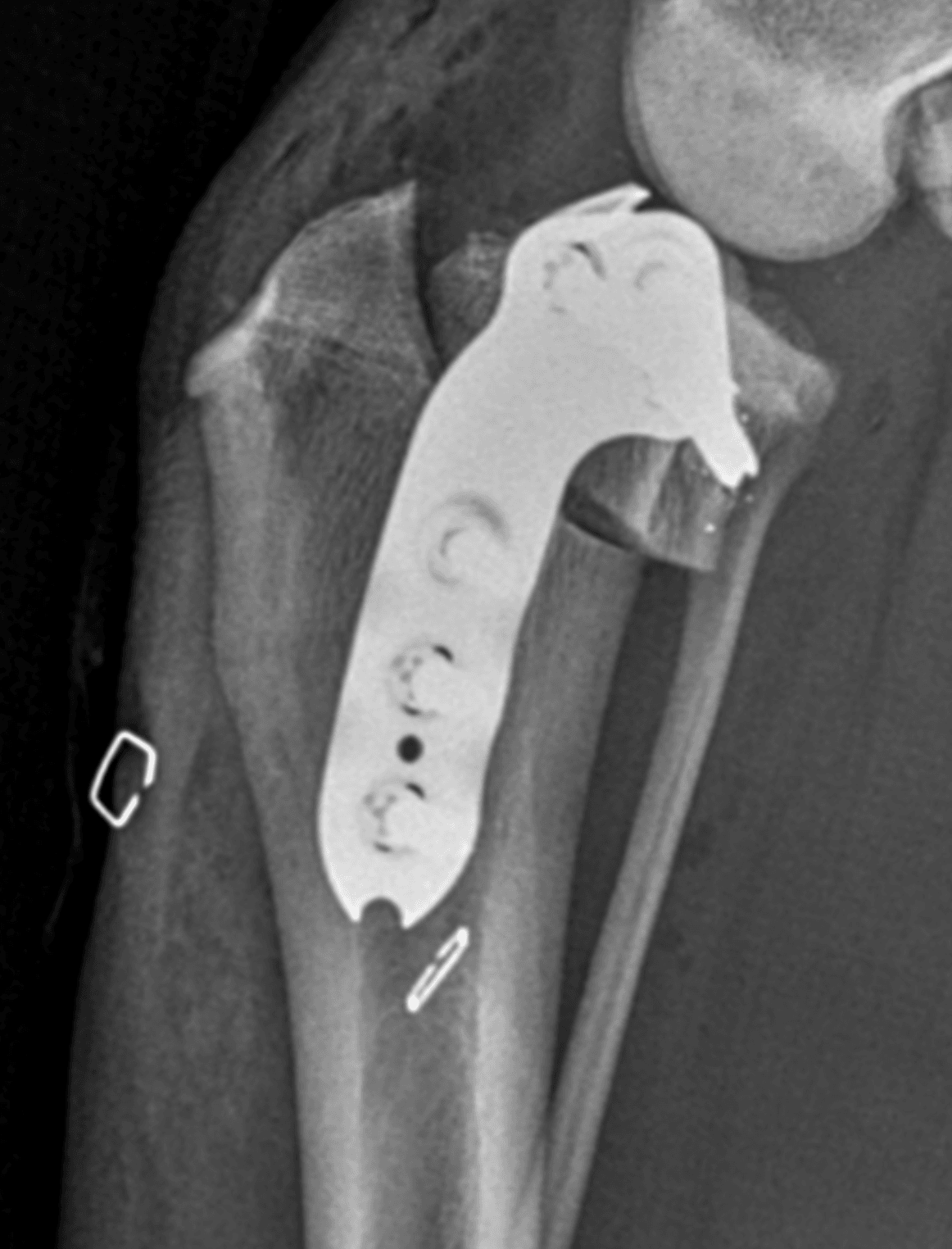 Post-operative radiograph showing the TPLO plate and screws fixed to the tibia after surgery